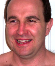Keith Dunkinson